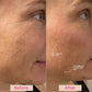 INDA™ Lumo Skin Elegance: Radiant Beauty for Your Skin